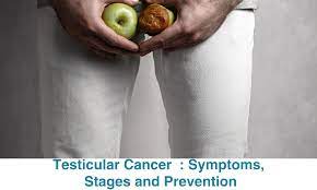 มะเร็งอวัยวะเพศชาย / มะเร็งองคชาต (Penile Cancer)